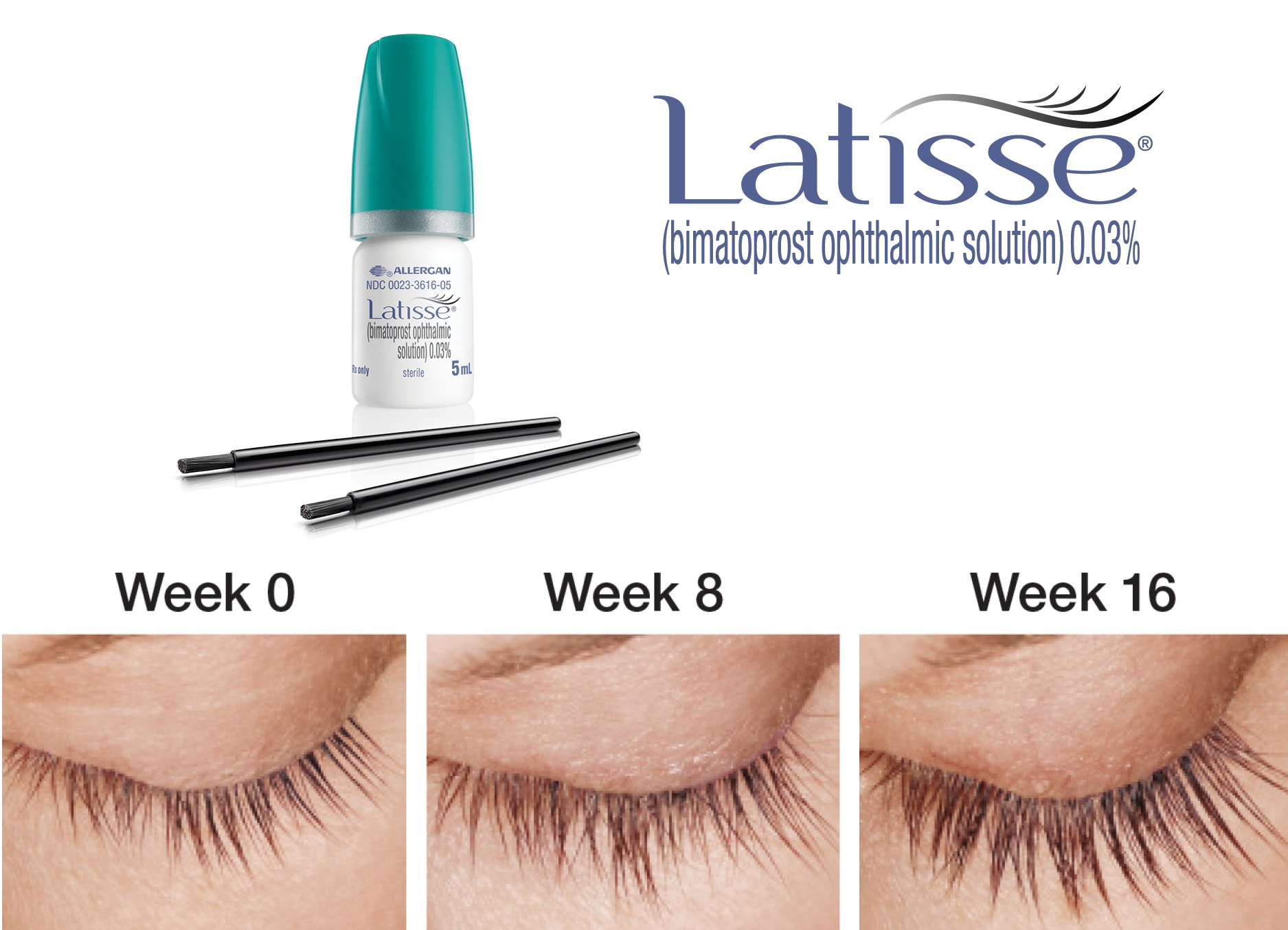Latisse drops eyelashes pictures at different stages of use