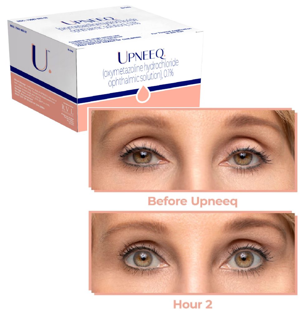Upneeq before and after