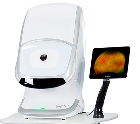 Optomap retinal imaging machine
